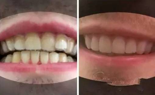 3D打印 3D打印